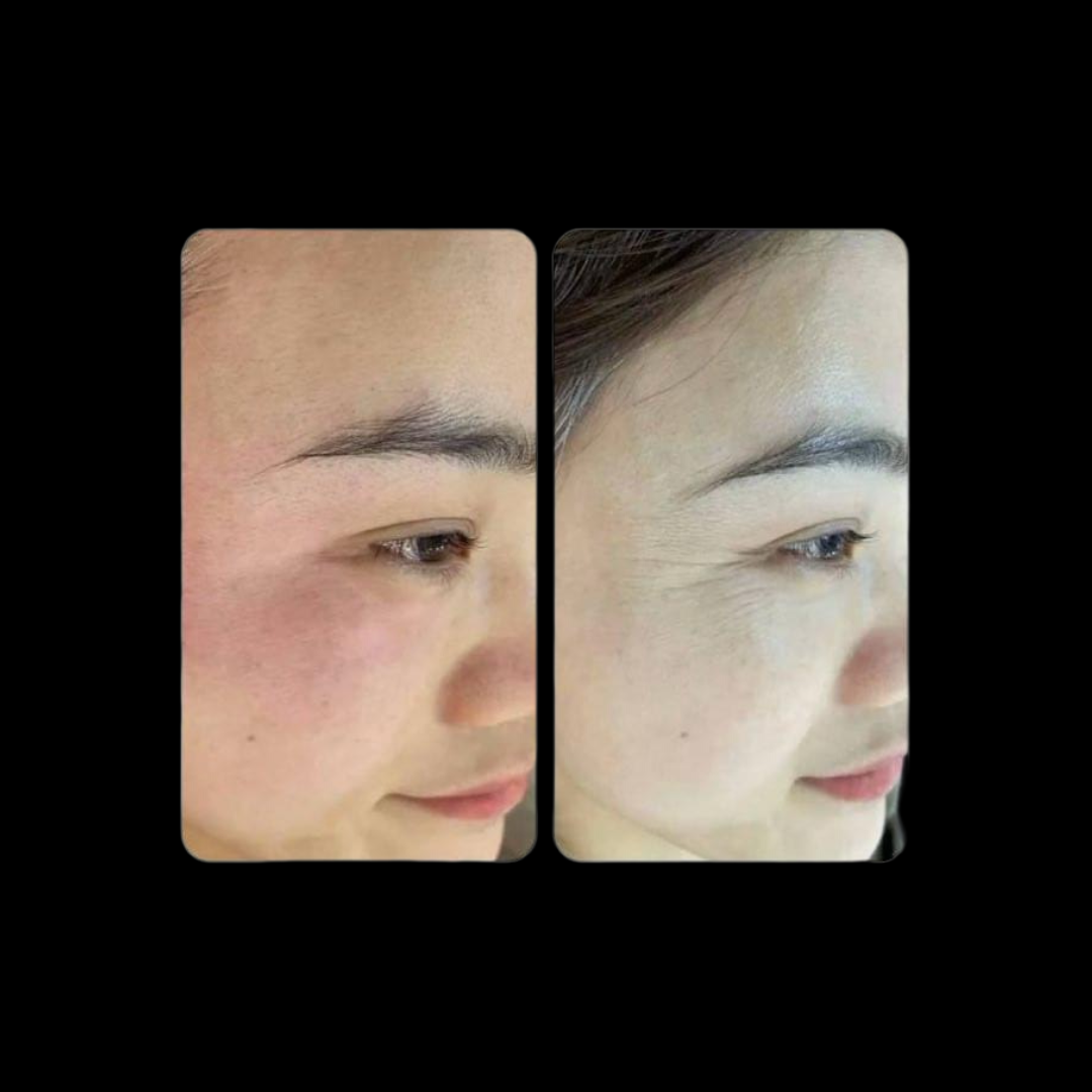 Anti-Wrinkles
