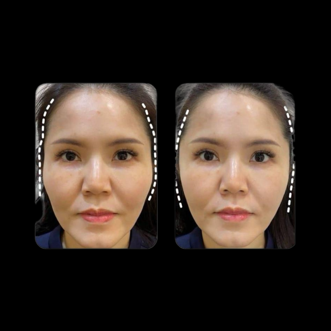 Collagen Support