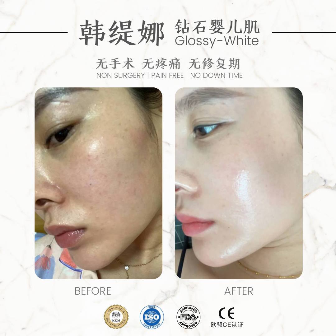 Baby skin 钻石婴儿肌