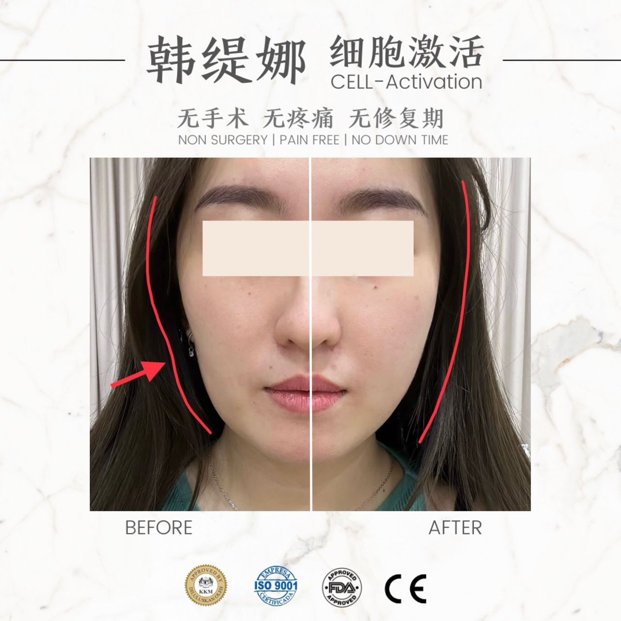 细胞激活