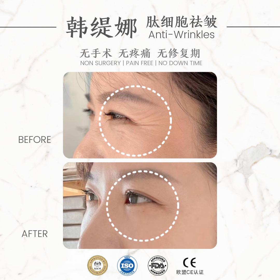 Anti eye wrinkle 眼睛祛皱