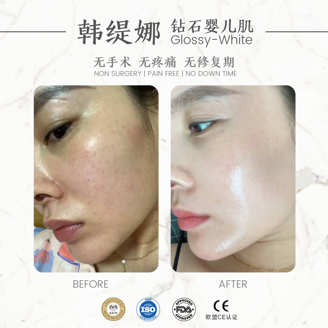 钻石婴儿肌