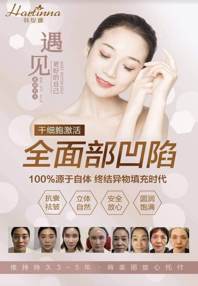 细胞激活术