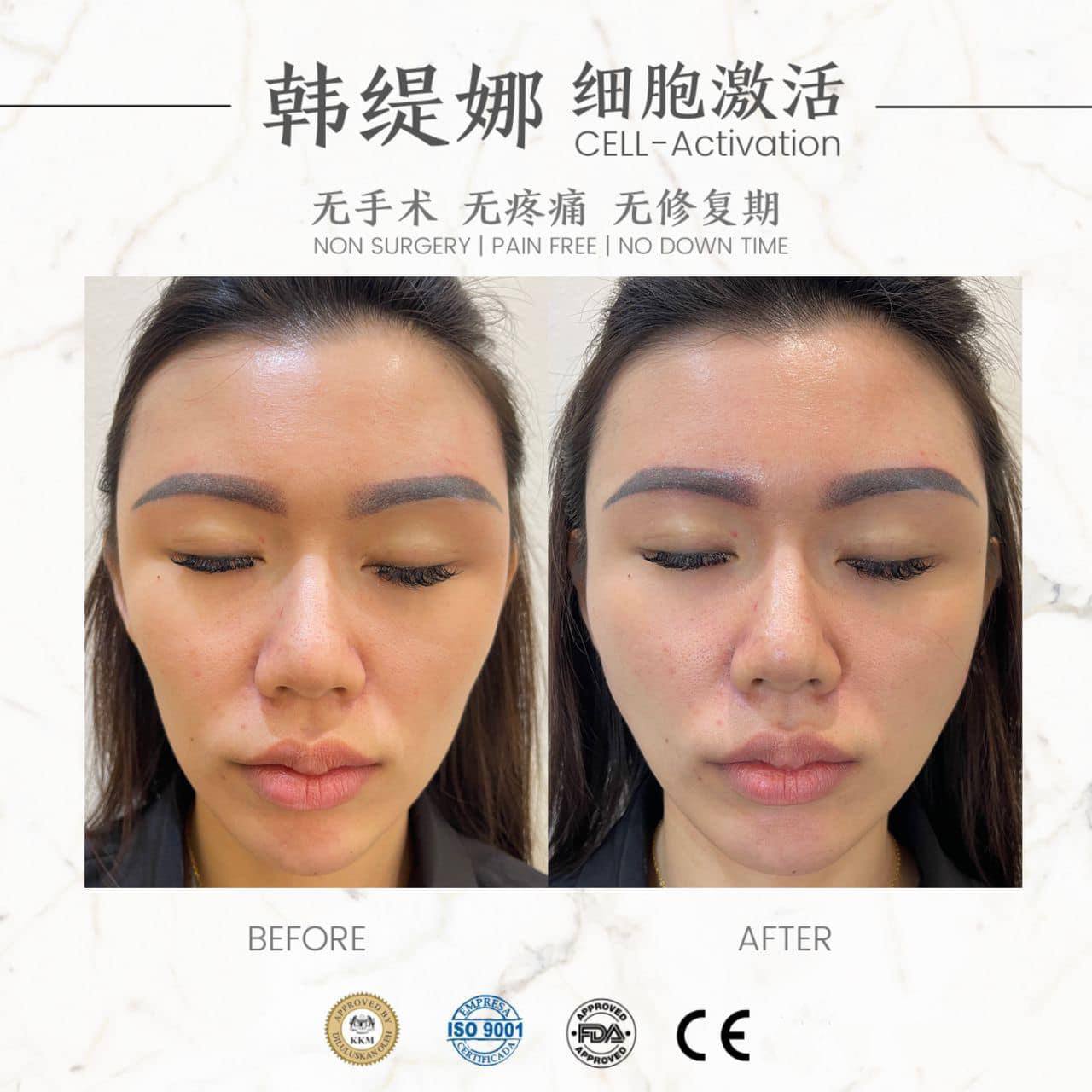 Young face 饱满少女招财脸