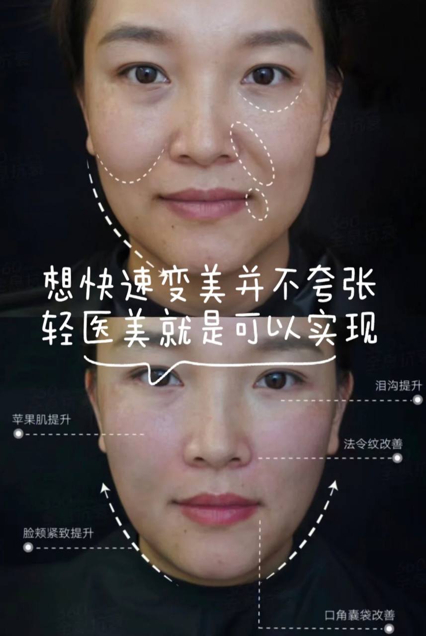 Young face 招财好运脸