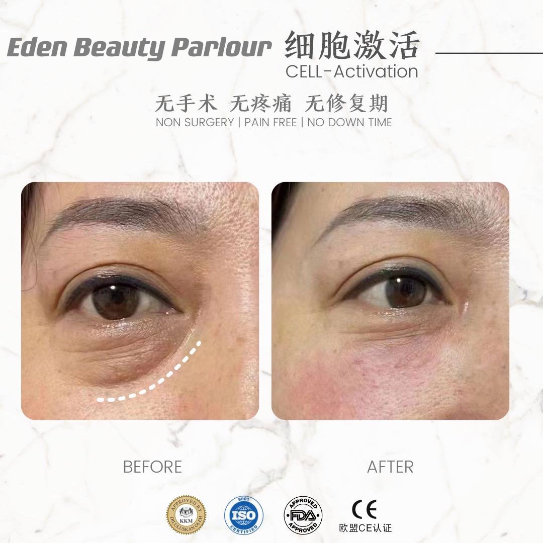 细胞激活